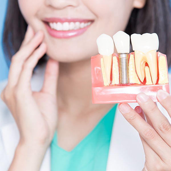 The image shows a smiling woman holding up a transparent model of a dental implant with visible screws, flanked by two rows of teeth replicas on either side.