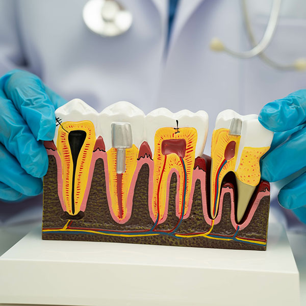 The image shows a dental professional holding up a model of a human mouth with teeth and gums, highlighting an area of interest for educational or instructional purposes.
