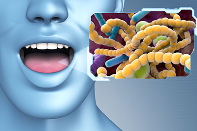 The image shows a person s face with an open mouth, displaying a yellowish substance that resembles bacteria or microorganisms, against a background of a blue sky.
