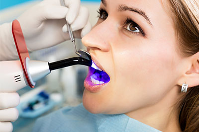 The image depicts a woman undergoing dental treatment, with a dentist using a blue light device on her teeth while wearing protective gloves and a surgical mask.