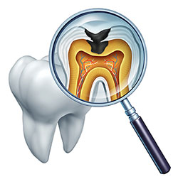 The image shows a magnified view of a human tooth with its root system visible, highlighting the anatomy of a dental implant, which includes a metal screw and a ceramic crown, set against a medical illustration background that depicts a cross-section of a tooth with internal structures like the pulp chamber and dentin.