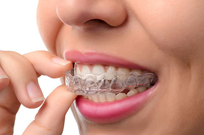 The image shows a person with braces, holding their teeth between their fingers, focusing on their smile while looking directly at the camera.
