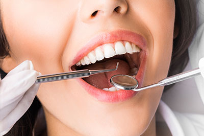 A woman with open mouth being attended to by dental professionals during a teeth cleaning procedure.