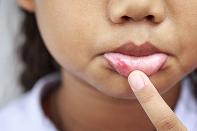 A young child with dark skin pointing at their lip with a finger.