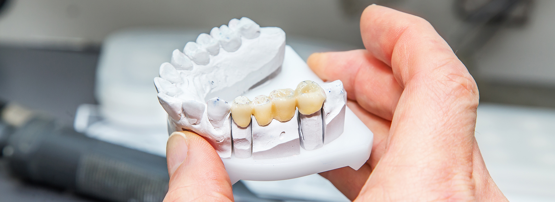 A person holding a set of dental implants with a focus on the teeth, against a blurred background.