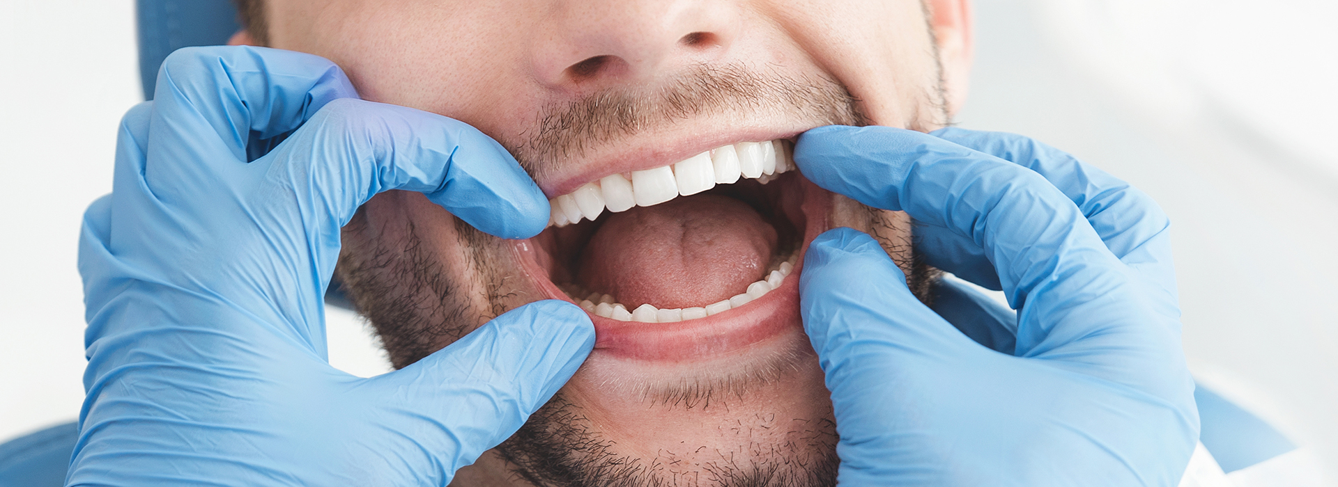 A man with his mouth wide open, being held by dental forceps by a person wearing blue gloves and a surgical mask.